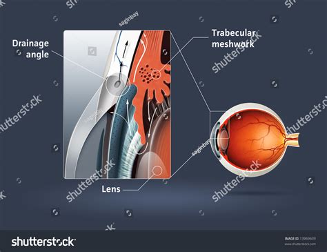 Human Eye - Glaucoma (Eye Disease) Stock Photo 13969639 : Shutterstock