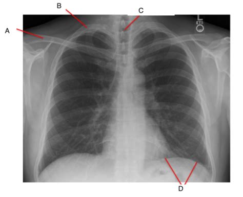 Diagnostic Methods I II Anatomical Structures On Plain Radiographs