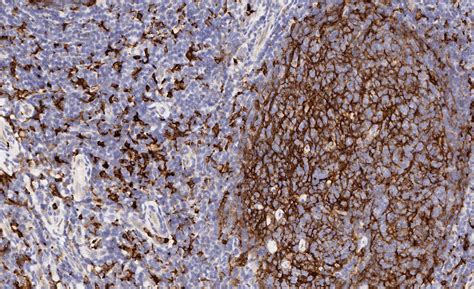 Macrophage Marker (CD11b, CD68, CD163, CD14, CD16) Antibody Panel ...