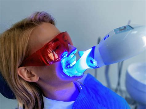 Professional Teeth Whitening Chelmsford Ma Drum Hill Dental