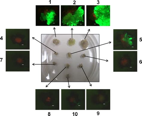 Transgene Expression As Monitored By Gfp Activity In Callus Cultures