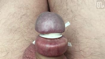 Stretched Foreskin And Tied Glands XVIDEOS