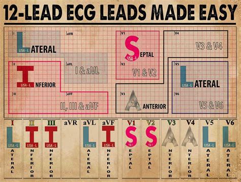 12-lead Ecg Leads Made Easy, Lateral, Septal, Inferior, Anterior, Lateral Wall Art - Etsy