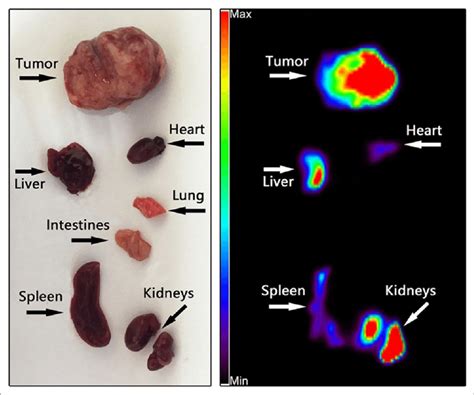 Ex Vivo Micro PET Imaging Of 68 Ga DOTA TATE After Dissecting Organs In