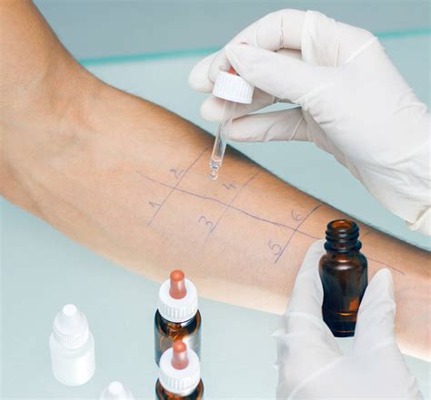 Skin Prick Tests Learn About Skin Prick Allergy Testing Today Us