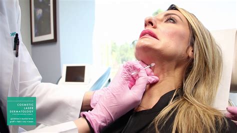 Platysmal Neck Band Treatment Botox Demonstration By Dr Monica Boen Youtube