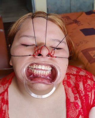 Face Bondage Nose Hook Porn Pictures Xxx Photos Sex Images Pictoa