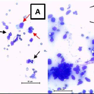 Cytological Demonstration Of Cervicitis And Endometritis In Crossbred