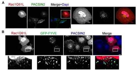 PACSIN2 A F BAR Domain Protein Creative Diagnostics