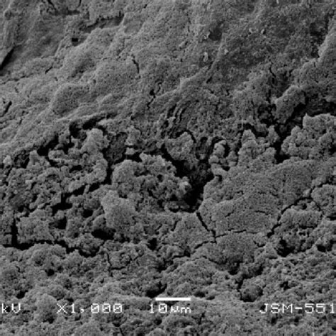 Marginal Adaptation Of Biodentine SЕМ ×1000 Magnification Download Scientific Diagram