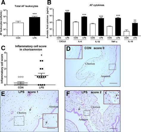 Effects Of Intra Amniotic Lipopolysaccharide Lps Exposure On