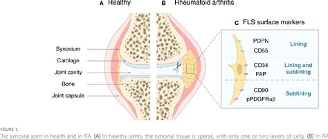 Role and mechanism of fibroblast activated protein α expression on the