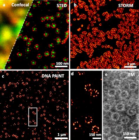 Super-resolution fluorescence microscopy of nuclear pore complexes with ...