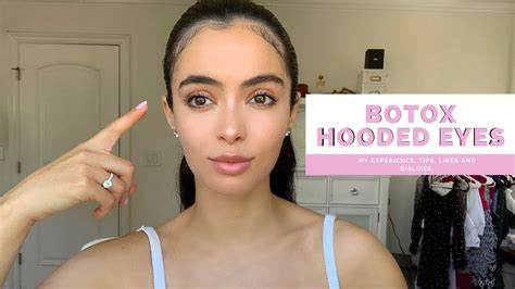 Botox Before And After Hooded Eyes Lift Youtube