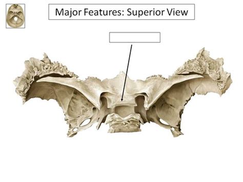 Sphenoid Bone Flashcards Quizlet