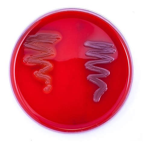 beta hemolysis stock  pictures royalty  images istock