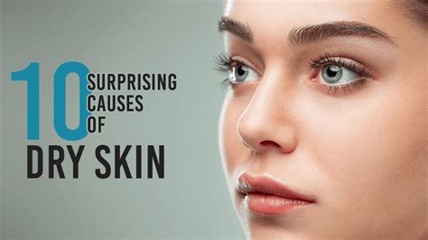 10 Surprising causes of Dry Skin | Vince Care