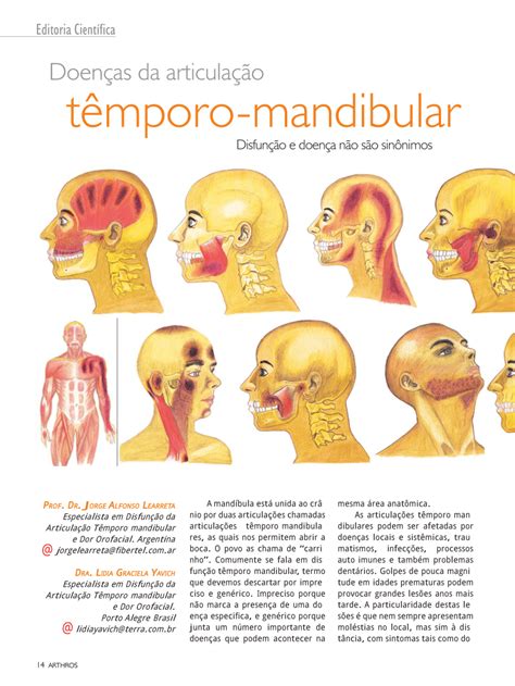 PDF Doenças da articulação têmporo mandibular Editoria Científica