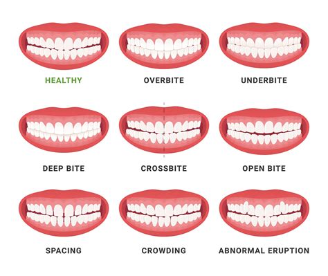 How To Tell If You Have A Bad Bite Northampton Dentist