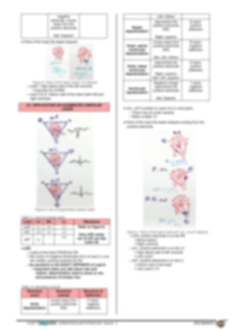 Solution Cardiovascular Physiology Ekg Basics How To Read Interpret