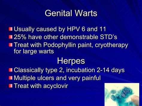 Benign Lesions Of The Cervix Vagina And Vulva Ppt Sexual Conditions Sexual Health
