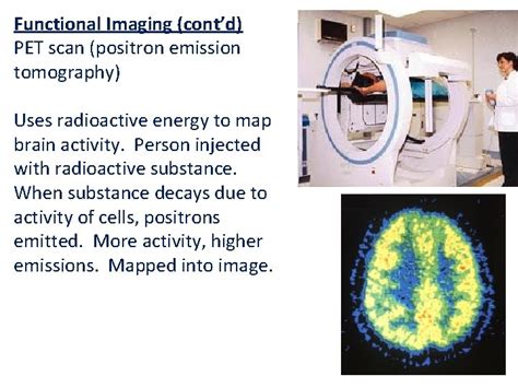 Types Of Brain Imaging Techniques Microelectrode Examines