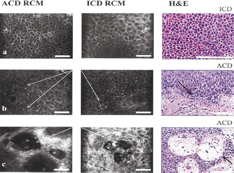 Confocal Laser Scanning Microscopy As A Tool For The Investigation Of