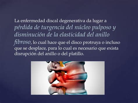 Patologia Degenerativa Del Disco INTERVERTEBRAL Pptx