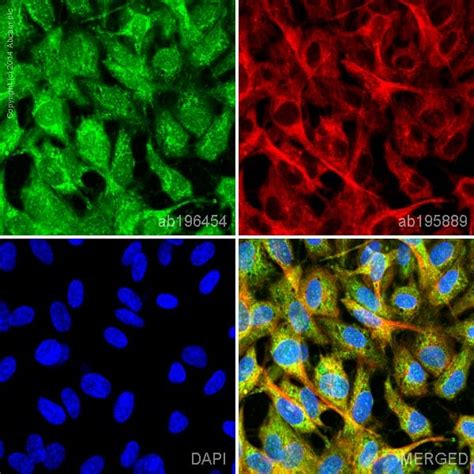 Alexa Fluor® 488 Anti-Vinculin antibody [EPR8185] (ab196454) | Abcam