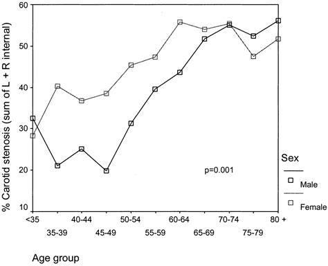 Sex Differences In Carotid Plaque And Stenosis Stroke