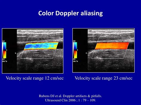 Principles Of Doppler Ultrasound