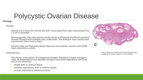 Pathology Of Polycystic Ovarian Disease And Endometriosis 2018 Sufia