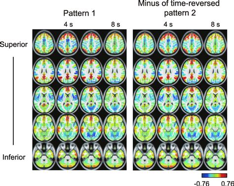 Relationship between estimated common spatiotemporal patterns. Common ... 