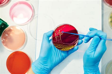 Sputum Culture Test Pictures