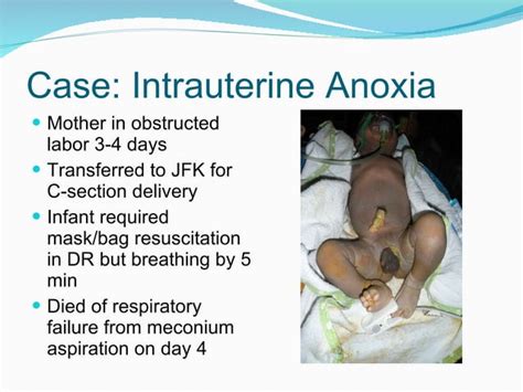 Anoxic Brain Injury Ppt