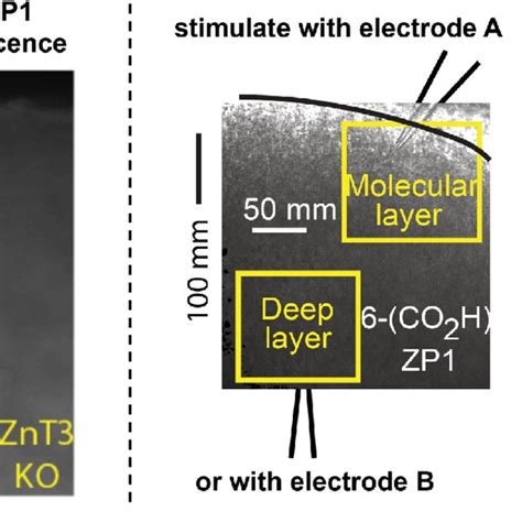 Mobile Zinc In Live DCN Tissue Slices Left Brightfield And