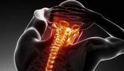 Awareness of Spinal Arthritis & Back Pain - The Physio Counsellors