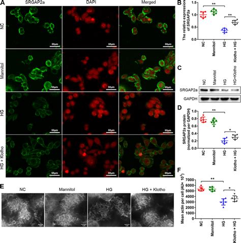 The Srgap A Expressions And Actin Cytoskeleton Of Podocytes Following