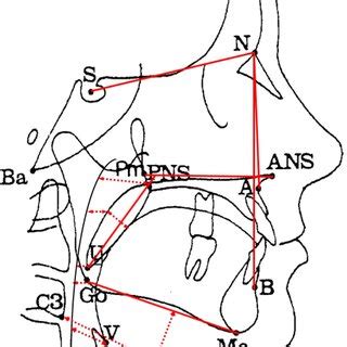 Cephalometric Landmarks And Linear And Angular Measurements S Sella