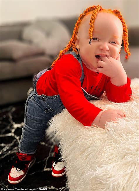 Exclusive Black Mother Who Gave Birth To An Albino Baby With Ginger