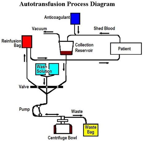 Autologous Blood Transfusion Indications And Types