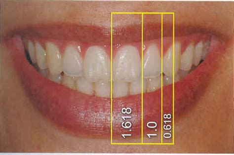 Protesis Dental Estetica Y Proporcion Ii