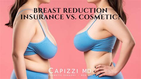 Before And After Plastic Surgery Breast Reduction