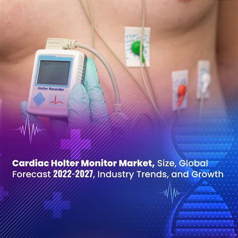 Cardiac Holter Monitor Market Size Global Forecast