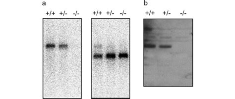 A Detection Of Gad65 Transcripts By Northern Blot Analysis Brain Download Scientific Diagram