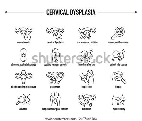 Cervical Dysplasia Symptoms Diagnostic Treatment Vector Stock Vector (Royalty Free) 2407446783 ...