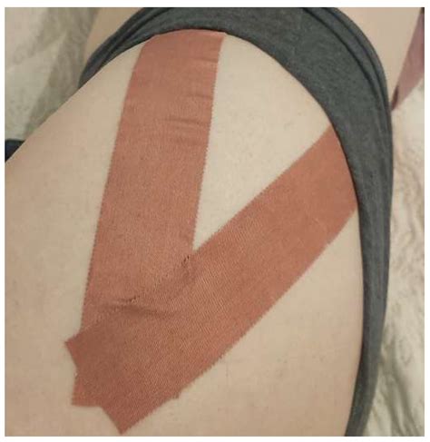 Ijerph Free Full Text Effects Of Kinesio Taping And Rigid Taping On