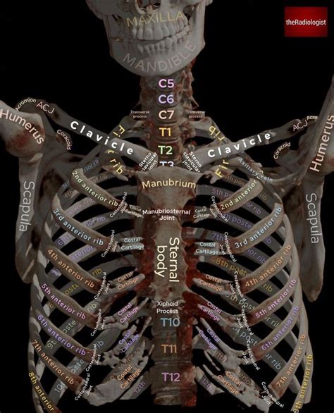 3D CT Thorax I MEDizzy