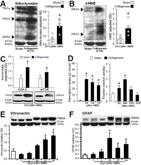 Figure 2 From Rodent Neonatal Germinal Matrix Hemorrhage Mimics The