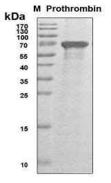 Recombinant Human Coagulation Factor II RayBiotech